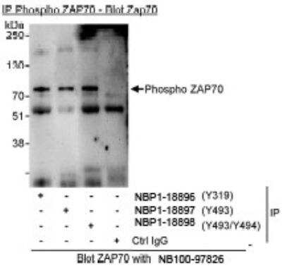 Immunoprecipitation: ZAP70 [p Tyr494] Antibody [NBP1-18898] - Whole cell lysate (1 mg for IP, 20% of IP loaded) from  Jurkat cells that had been treated with hydrogen peroxide.  Antibodies: Affinity purified rabbit anti-Phospho ZAP70  antibodies NBP1-18896 (for phosphorylation at Y319),  NBP1-18897 (for phosphorylation at Y493), and NBP1-18898 (for  phosphorylation at Y493/Y494) used for IP at 3 mcg/mg lysate.